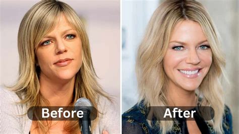 dee reynolds bikini|Kaitlin Olsons Plastic Surgery